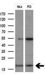 CDKN2A Antibody in Western Blot (WB)