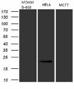 CDKN2A Antibody in Western Blot (WB)