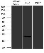 CDKN2A Antibody in Western Blot (WB)