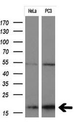 CDKN2A (p16INK4a) Antibody in Western Blot (WB)