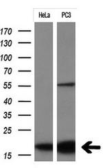 CDKN2A (p16INK4a) Antibody in Western Blot (WB)
