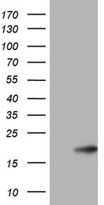 CDKN2A Antibody in Western Blot (WB)