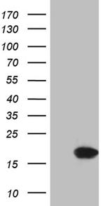 CDKN2A Antibody in Western Blot (WB)