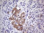 CDKN2A (p16INK4a) Antibody in Immunohistochemistry (Paraffin) (IHC (P))