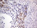 CDKN2A (p16INK4a) Antibody in Immunohistochemistry (Paraffin) (IHC (P))