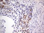 CDKN2A (p16INK4a) Antibody in Immunohistochemistry (Paraffin) (IHC (P))