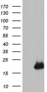 CDKN2A (p16INK4a) Antibody in Western Blot (WB)