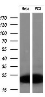 CDKN2A (p16INK4a) Antibody in Western Blot (WB)