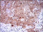 p16INK4a Antibody in Immunohistochemistry (Paraffin) (IHC (P))