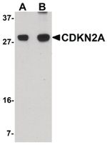 p16INK4a Antibody in Western Blot (WB)