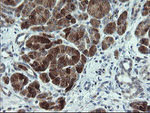 CDKN2B Antibody in Immunohistochemistry (Paraffin) (IHC (P))