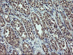 CDKN2B Antibody in Immunohistochemistry (Paraffin) (IHC (P))