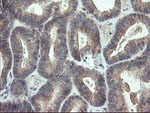 CDKN2B Antibody in Immunohistochemistry (Paraffin) (IHC (P))