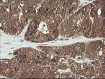 CDKN2B Antibody in Immunohistochemistry (Paraffin) (IHC (P))