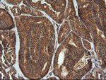 CDKN2B Antibody in Immunohistochemistry (Paraffin) (IHC (P))