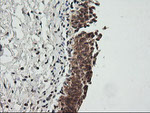CDKN2B Antibody in Immunohistochemistry (Paraffin) (IHC (P))