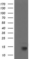 CDKN2B Antibody in Western Blot (WB)