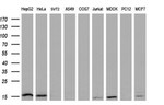 CDKN2B Antibody in Western Blot (WB)
