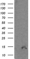 CDKN2B Antibody in Western Blot (WB)