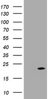 CDKN2C Antibody in Western Blot (WB)