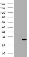 CDKN2C Antibody in Western Blot (WB)