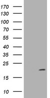 CDKN2C Antibody in Western Blot (WB)