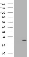 CDKN2C Antibody in Western Blot (WB)