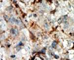 CDKN3 Antibody in Immunohistochemistry (IHC)
