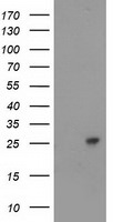 CDKN3 Antibody in Western Blot (WB)