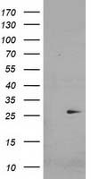 CDKN3 Antibody in Western Blot (WB)