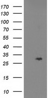 CDKN3 Antibody in Western Blot (WB)