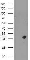 CDKN3 Antibody in Western Blot (WB)