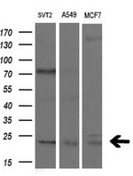 CDKN3 Antibody in Western Blot (WB)