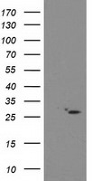 CDKN3 Antibody in Western Blot (WB)