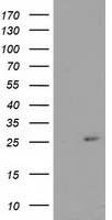 CDKN3 Antibody in Western Blot (WB)