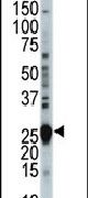 CDKN3 Antibody in Western Blot (WB)