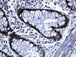 CDX1 Antibody in Immunohistochemistry (Paraffin) (IHC (P))