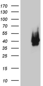 CDX1 Antibody in Western Blot (WB)