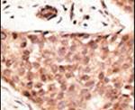 CDX2 Antibody in Immunohistochemistry (IHC)