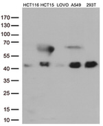 CDX2 Antibody in Western Blot (WB)