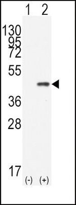 CDX2 Antibody in Western Blot (WB)