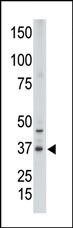 CDX2 Antibody in Western Blot (WB)
