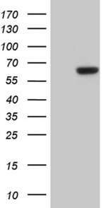 CDY2B Antibody in Western Blot (WB)
