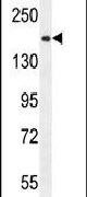 CEP164 Antibody in Western Blot (WB)