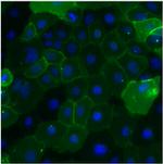 CEA Monoclonal Antibody (1106)