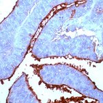 CEA Antibody in Immunohistochemistry (IHC)
