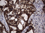 CEA (CEACAM5) Antibody in Immunohistochemistry (Paraffin) (IHC (P))