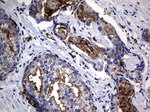 CEA (CEACAM5) Antibody in Immunohistochemistry (Paraffin) (IHC (P))