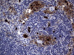 CEA (CEACAM5) Antibody in Immunohistochemistry (Paraffin) (IHC (P))
