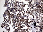 CEA (CEACAM5) Antibody in Immunohistochemistry (Paraffin) (IHC (P))